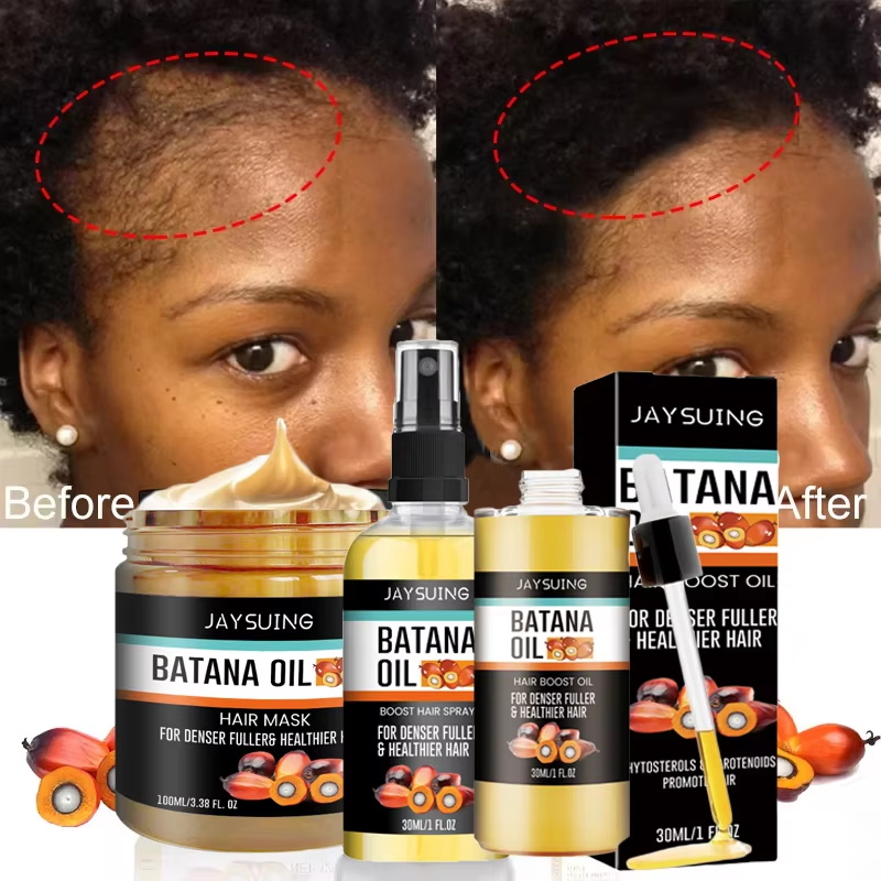 Batana-Öl Dickes Haar-Serum-Sp – Hair Care Essence Oil Spray Bewertung und Preis