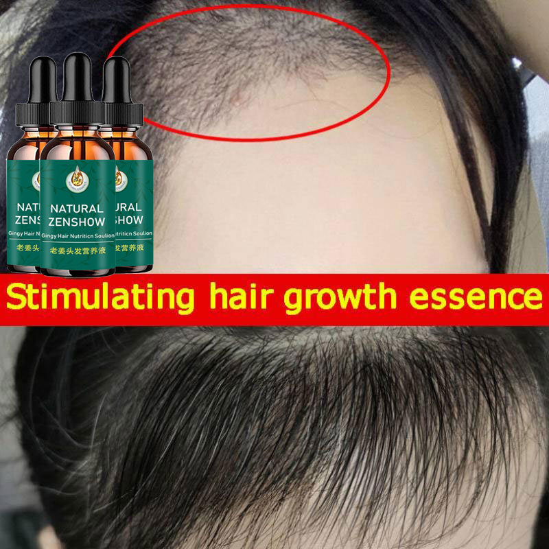 Ingwer Haarwuchs ätherisches Ö – Hair Care Herbal Bewertung und Preis