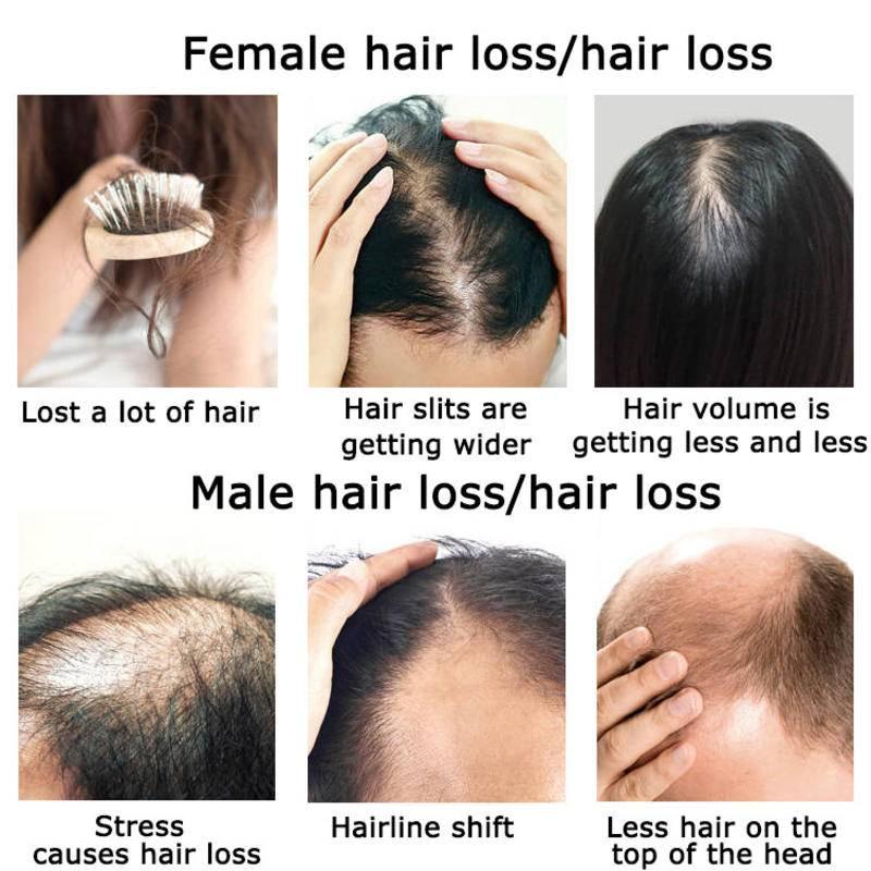 Ingwer Haarwuchs ätherisches Ö – Hair Care Herbal Bewertung und Preis