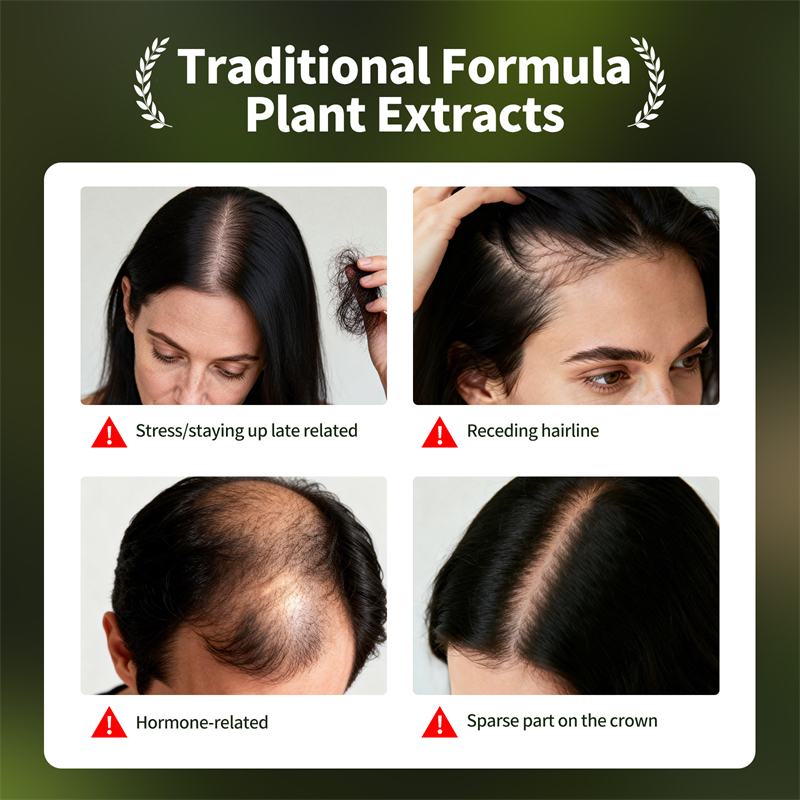 Natürliches Haarwachstumsset U – Hair Care Herbal Bewertung und Preis