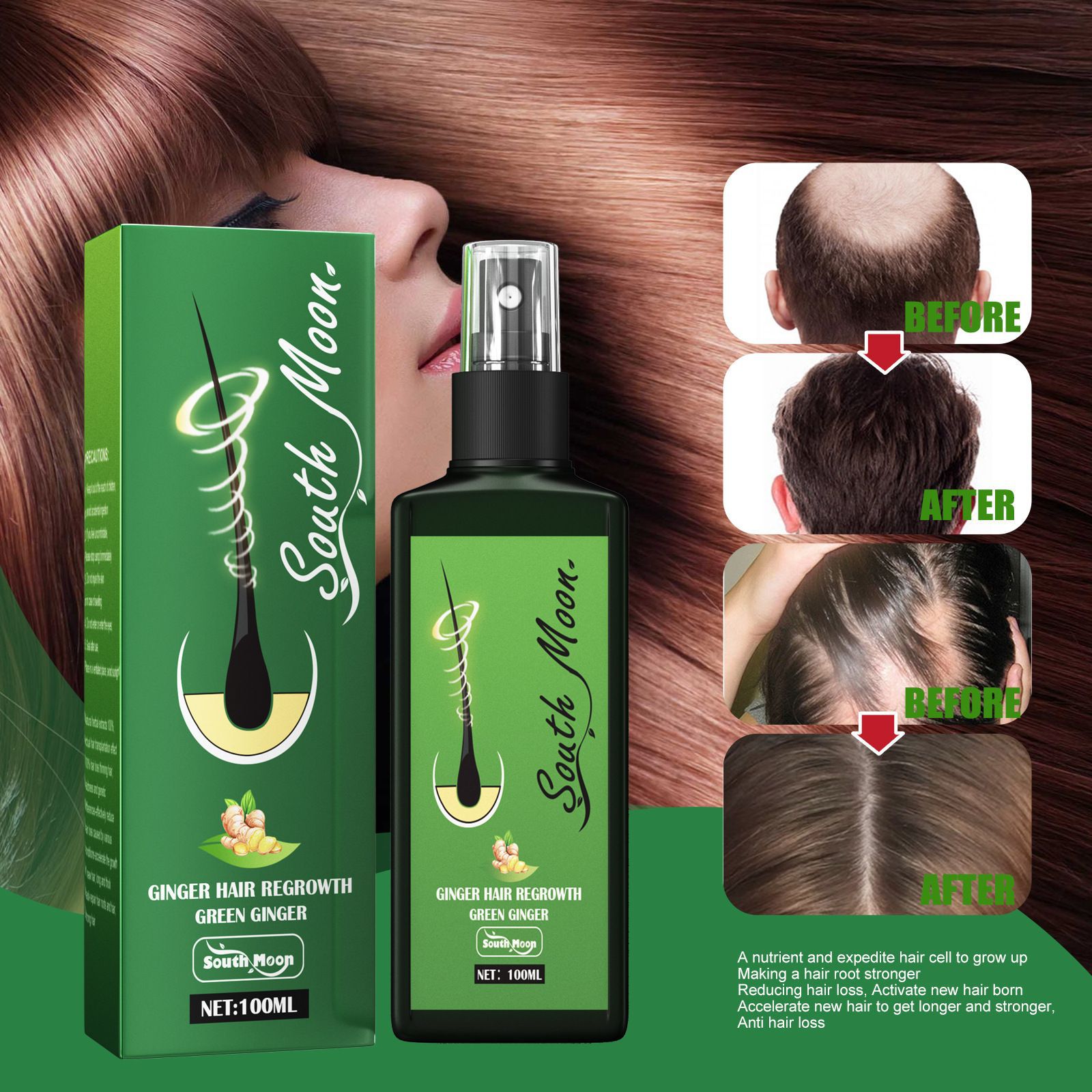 South Moon Ingwer Haarwuchsspr – Hair Care Herbal Bewertung und Preis