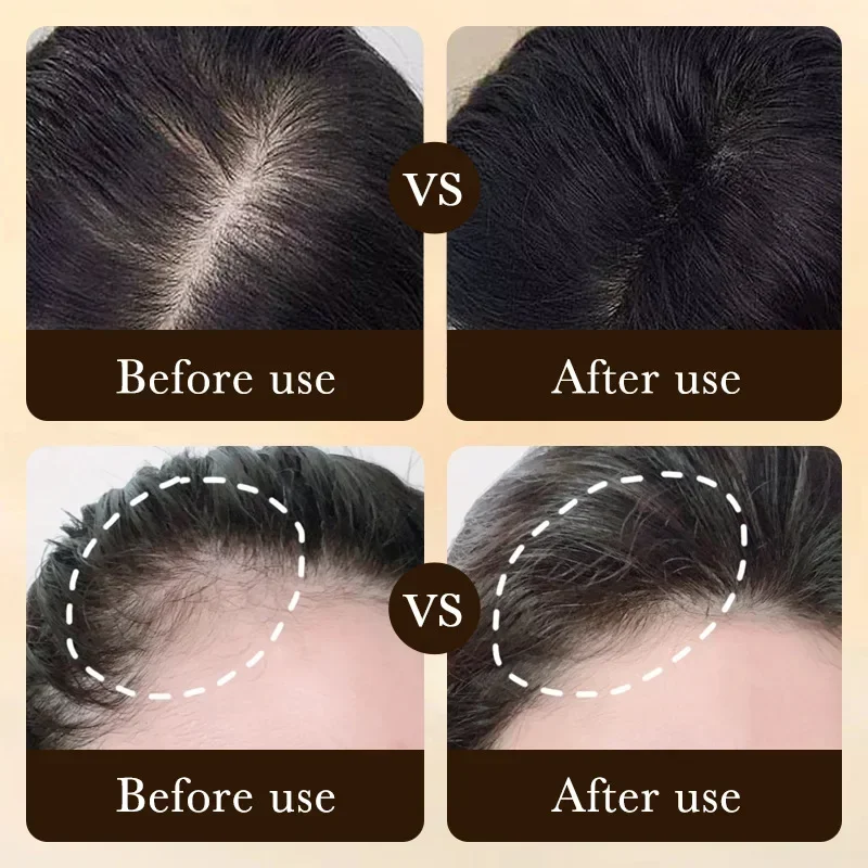 Biotin Schnelles Haarwuchsöl P – Hair Care Fragrance Essential Oil Bewertung und Preis