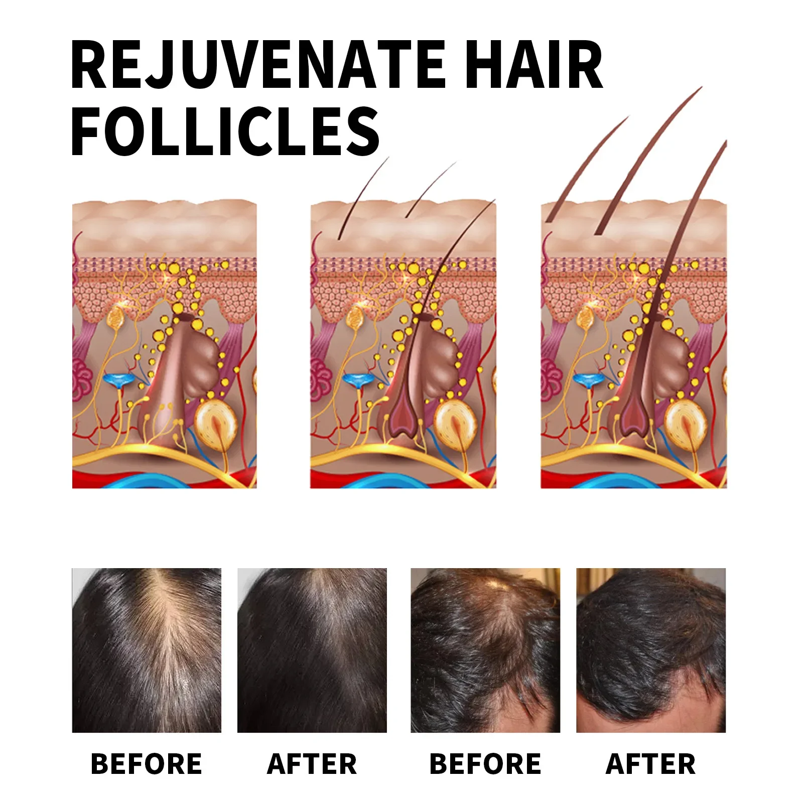 Ingwer-Haarwachstumsprodukte,  – Hair Care For Dry And Frizzy Hair Bewertung und Preis