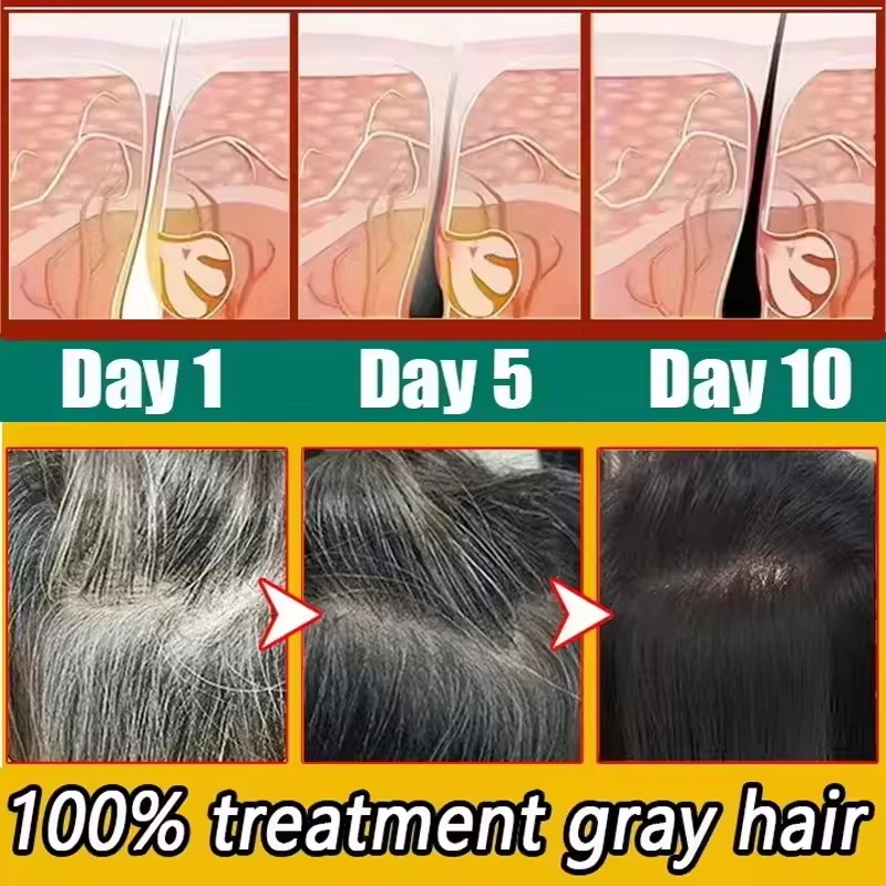 Kräuter-Anti-Grau-Haar-Behandl – Hair Care Herbal Products Bewertung und Preis