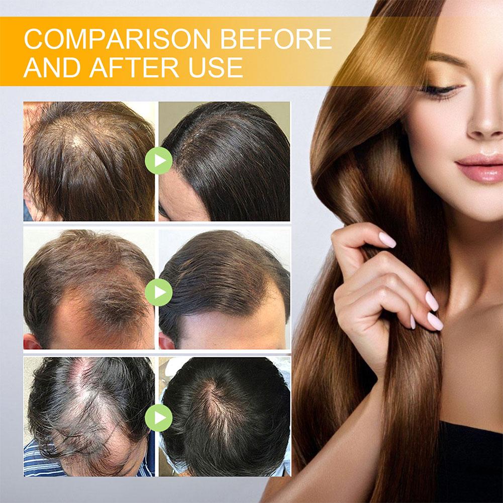 5/3/1 stücke Biotin Schnelle H – Hair Care Herbal Bewertung und Preis